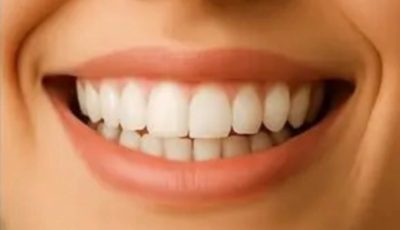 Natural Teeth Whitening at Home: A Safer, Simpler Way to Brighten Your Smile