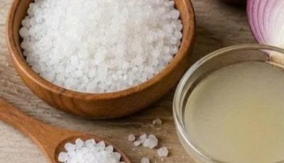 5 Natural Home Remedies for Dry, Cracked Heels That Really Help
