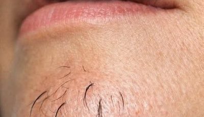 A woman’s chin hair is a sign of… See more