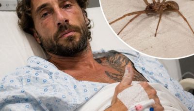 Vittorio Brumotti Was Bitten by the Violin Spider: A Frightening Encounter That Shocked Fans