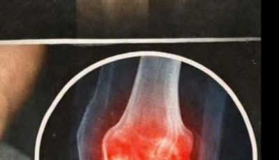 Joint Health Smoothie: A Nutrient-Rich Recipe to Support Cartilage, Ligaments, and Healthy Mobility