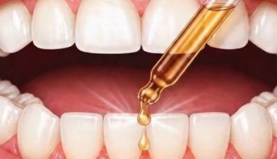 10 All Natural Toothache Remedies That Your Dentist Doesn’t Want You To Know About